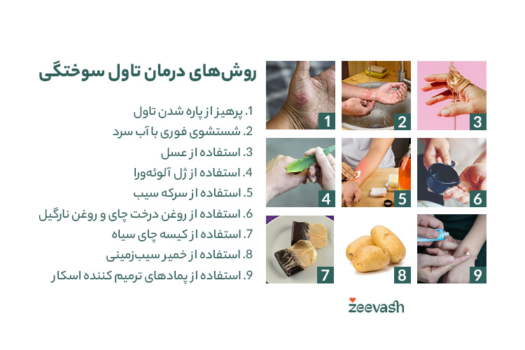 روش های درمان تاول سوختگی